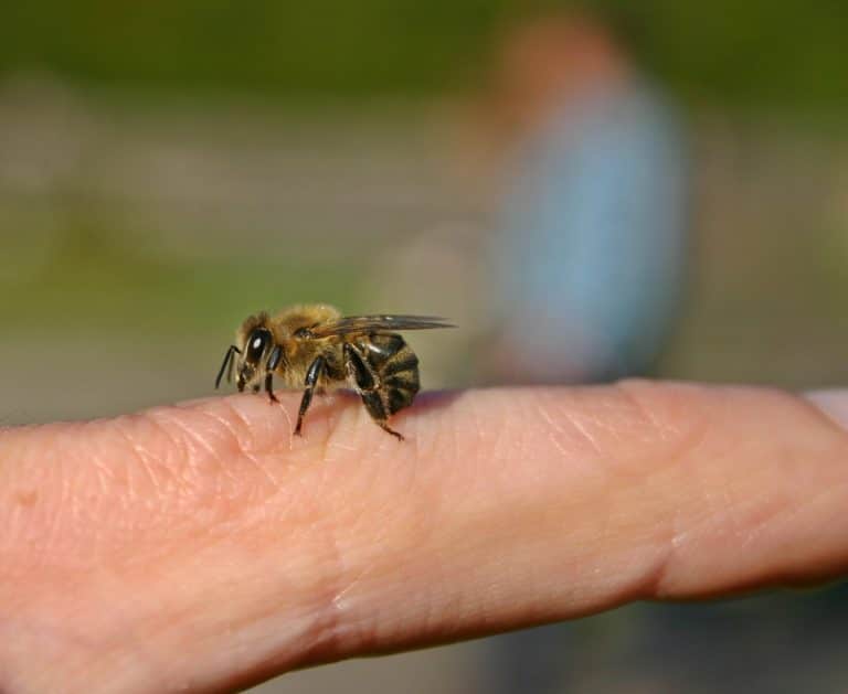piqûre d'abeille